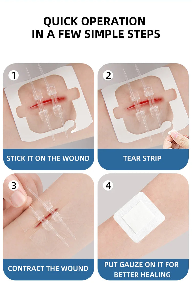 2pcs Zipper Tie Wound Closure Patch Hemostatic Patch Wound Fast Suture Zipper Band-Aid Outdoor Portable
