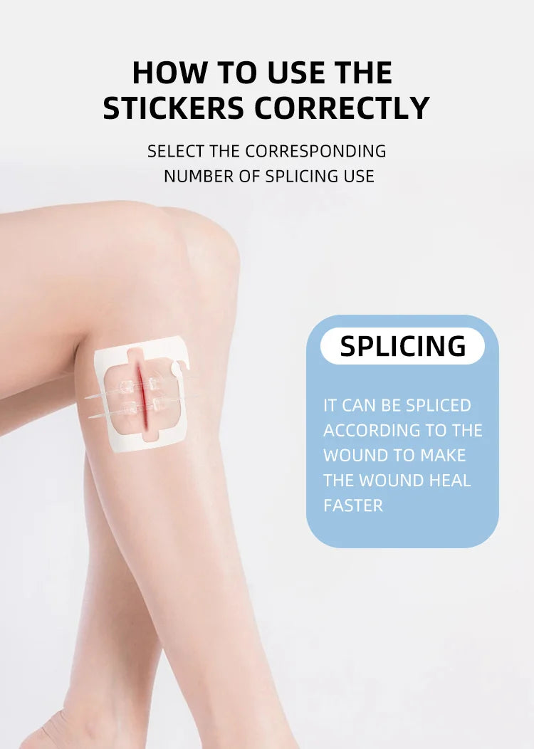 2pcs Zipper Tie Wound Closure Patch Hemostatic Patch Wound Fast Suture Zipper Band-Aid Outdoor Portable