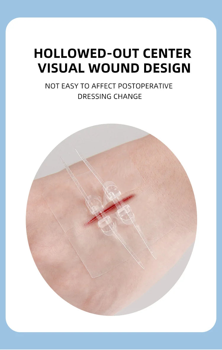 2pcs Zipper Tie Wound Closure Patch Hemostatic Patch Wound Fast Suture Zipper Band-Aid Outdoor Portable