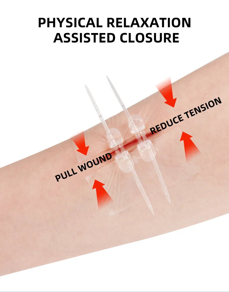 2pcs Zipper Tie Wound Closure Patch Hemostatic Patch Wound Fast Suture Zipper Band-Aid Outdoor Portable